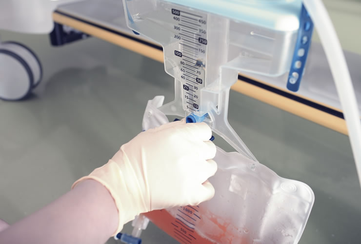 Sacos Colectores de Urina